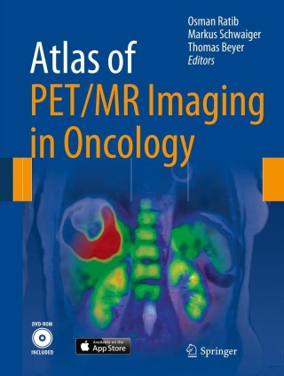 صورة الغلاف: Atlas of PET/MR Imaging in Oncology 9783642312915