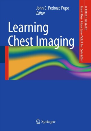 Cover image: Learning Chest Imaging 9783642341465