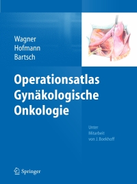 Cover image: Operationsatlas Gynäkologische Onkologie 9783642351273