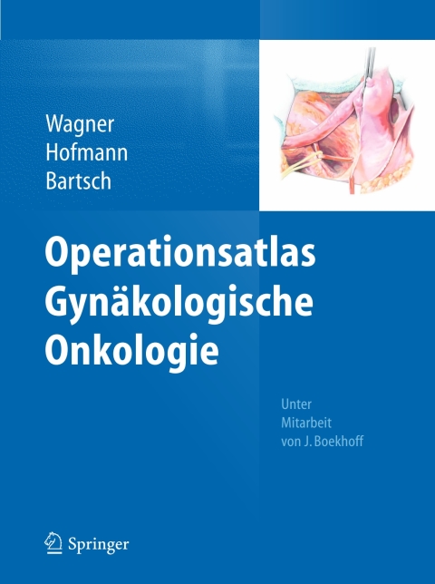 Operationsatlas Gynäkologische Onkologie - FULL INSTANT DOWNLOAD | PDF DOCX EPUB