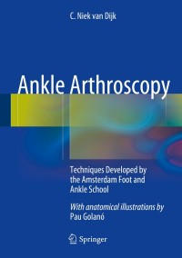Immagine di copertina: Ankle Arthroscopy 9783642359880