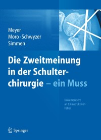 Omslagafbeelding: Die Zweitmeinung in der Schulterchirurgie - ein Muss 9783642370939