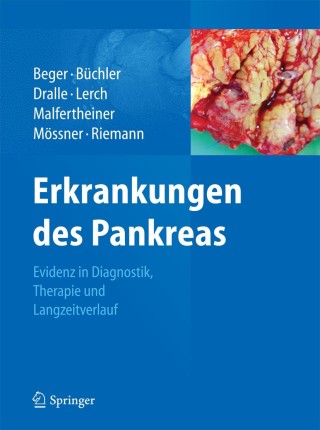 Immagine di copertina: Erkrankungen des Pankreas 9783642379635