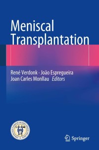 Titelbild: Meniscal Transplantation 9783642381058