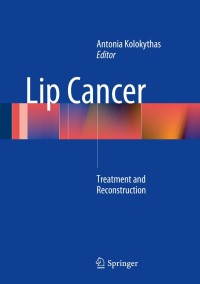 Cover image: Lip Cancer 9783642381799