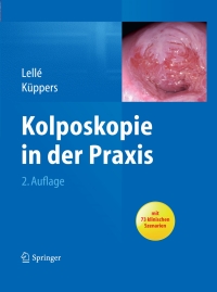 Omslagafbeelding: Kolposkopie in der Praxis 2nd edition 9783642383076