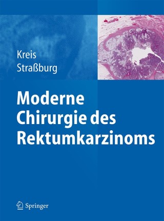 Cover image: Moderne Chirurgie des Rektumkarzinoms 9783642403897