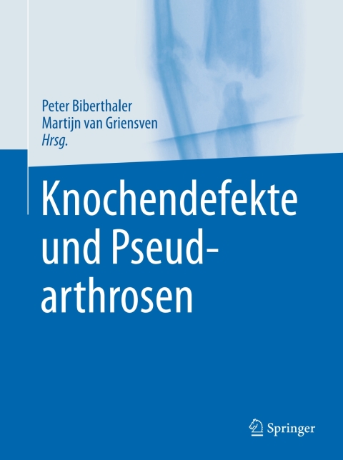 Knochendefekte und Pseudarthrosen - FULL INSTANT DOWNLOAD | PDF DOCX EPUB