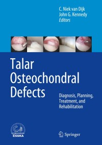 صورة الغلاف: Talar Osteochondral Defects 9783642450969