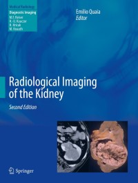 表紙画像: Radiological Imaging of the Kidney 2nd edition 9783642540462