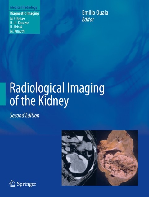 Radiological Imaging of the Kidney, 2nd Edition - FULL INSTANT DOWNLOAD | PDF DOCX EPUB