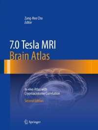 Immagine di copertina: 7.0 Tesla MRI Brain Atlas 2nd edition 9783642543975