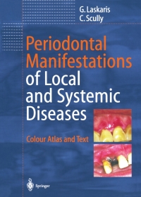 Omslagafbeelding: Periodontal Manifestations of Local and Systemic Diseases 9783642627880