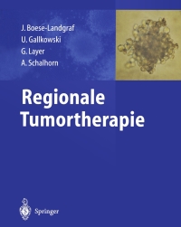 Omslagafbeelding: Regionale Tumortherapie 1st edition 9783540417620