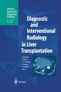 Omslagafbeelding: Diagnostic and Interventional Radiology in Liver Transplantation 1st edition 9783540633112