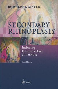 صورة الغلاف: Secondary Rhinoplasty 2nd edition 9783540658849