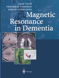 صورة الغلاف: Magnetic Resonance in Dementia 9783642625978
