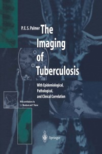 Cover image: The Imaging of Tuberculosis 9783642626104