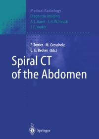 Cover image: Spiral CT of the Abdomen 1st edition 9783540634638