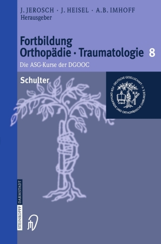 Cover image: Schulter 1st edition 9783798514416