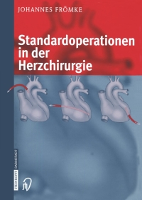 Cover image: Standardoperationen in der Herzchirurgie 9783642632471