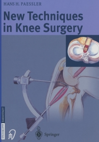 Imagen de portada: New Techniques in Knee Surgery 9783798513877