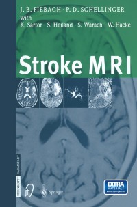 Omslagafbeelding: Stroke MRI 9783798513723