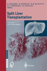 Imagen de portada: Split liver transplantation 1st edition 9783798512566