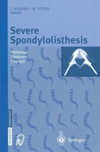 Cover image: Severe Spondylolisthesis 1st edition 9783798512535