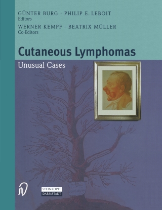 Imagen de portada: Cutaneous Lymphomas 1st edition 9783798512504