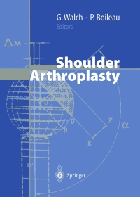 صورة الغلاف: Shoulder Arthroplasty 1st edition 9783540633495