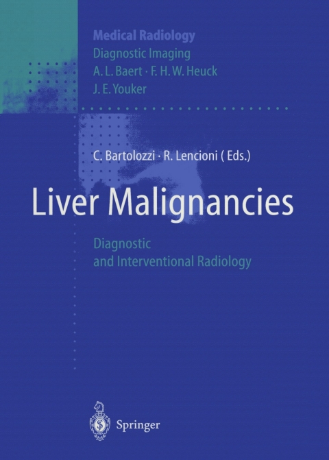 Liver Malignancies: Diagnostic and Interventional Radiology, 1st Edition - FULL INSTANT DOWNLOAD | PDF DOCX EPUB