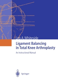 Cover image: Ligament Balancing in Total Knee Arthroplasty 9783540207498