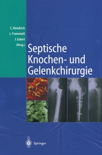 Imagen de portada: Septische Knochen-und Gelenkchirurgie 1st edition 9783540213413