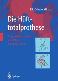 Cover image: Die Hüfttotalprothese 1st edition 9783540430483