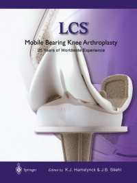 Immagine di copertina: LCS® Mobile Bearing Knee Arthroplasty 1st edition 9783540432845