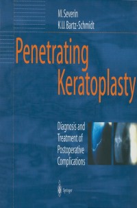 表紙画像: Penetrating Keratoplasty 9783642640834