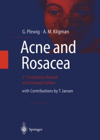 Cover image: ACNE and ROSACEA 3rd edition 9783642640964