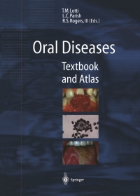 Cover image: Oral Diseases 1st edition 9783540624165