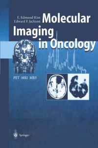 Cover image: Molecular Imaging in Oncology 9783540641018
