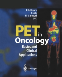 Imagen de portada: PET in Oncology 1st edition 9783540650775