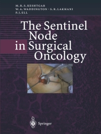 Titelbild: The Sentinel Node in Surgical Oncology 9783642642302