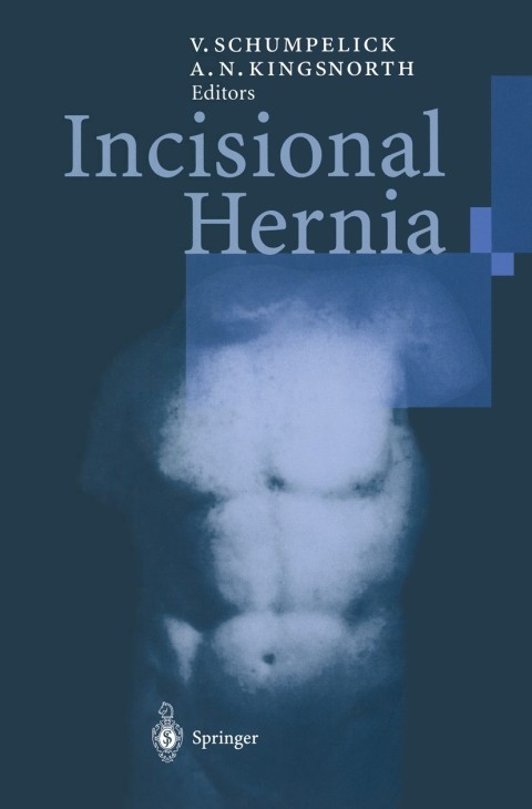 Incisional Hernia, 1st Edition - FULL INSTANT DOWNLOAD | PDF DOCX EPUB