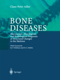 Cover image: Bone Diseases 9783540650614