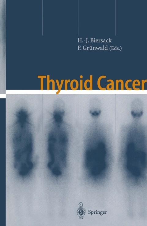 Thyroid Cancer, 1st Edition - FULL INSTANT DOWNLOAD | PDF DOCX EPUB