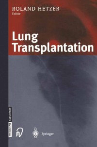 Cover image: Lung Transplantation 1st edition 9783798510623