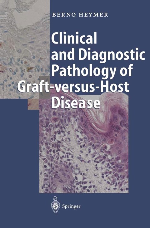 Clinical and Diagnostic Pathology of Graft-versus-Host Disease - FULL INSTANT DOWNLOAD | PDF DOCX EPUB