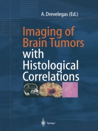 Cover image: Imaging of Brain Tumors with Histological Correlations 1st edition 9783540410928