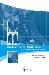 Imagen de portada: Protocols for Multislice CT 1st edition 9783540430407