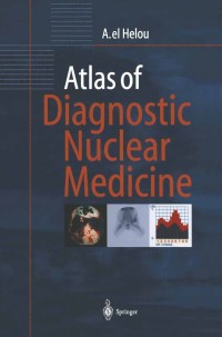 Immagine di copertina: Atlas of Diagnostic Nuclear Medicine 9783540651758